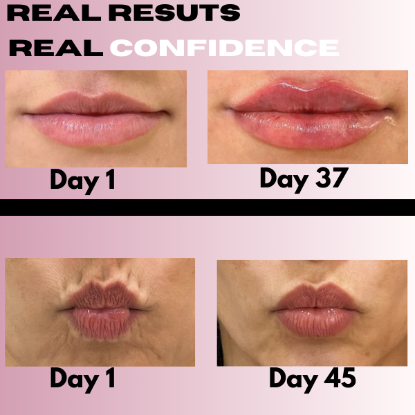 Slyner™LipBloom