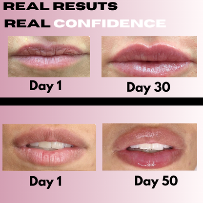 Slyner™LipBloom